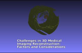 Challenges in 3D Medical Imaging Reconstruction Factors and Considerations Zoe Amin Akhlaghi